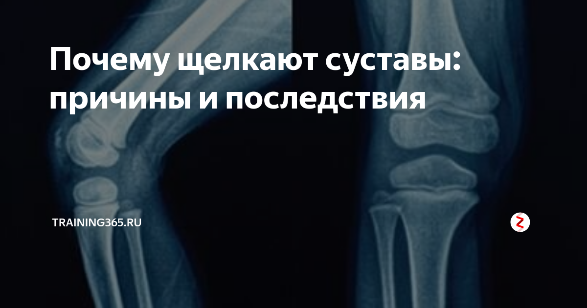 Последствия щелкание суставов. Щелканье суставов зависимость. Рекомендации при щелчке в суставе.