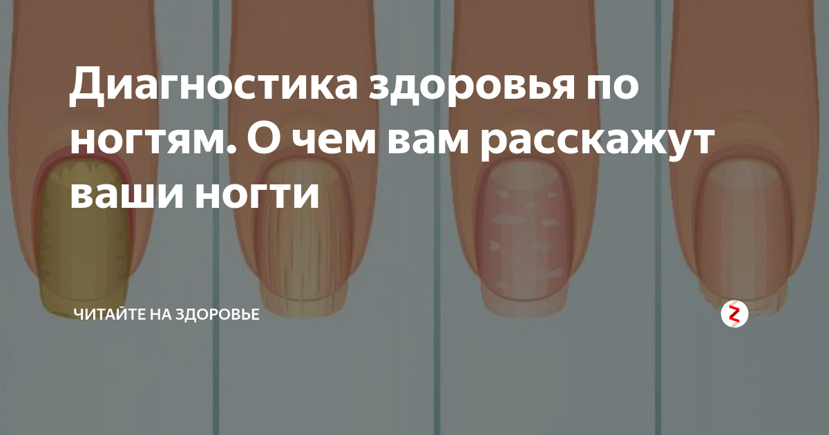 Диагностика ногтей фото