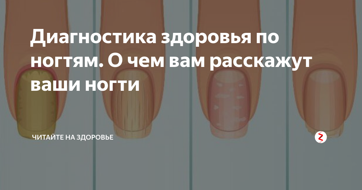 По ногтям определить человеком. Состояние здоровья по ногтям. Определить болезнь по ногтям. Ногти и болезни по ногтям.