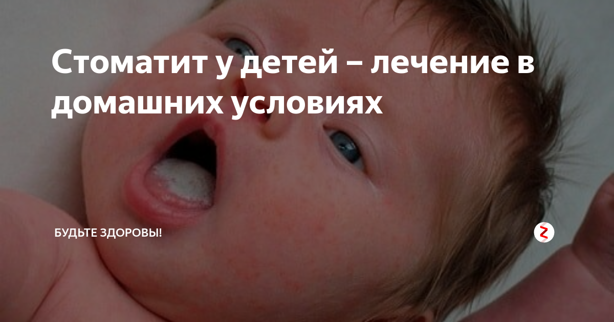 Стоматит у детей лечение фото Презентацию Острый герпетический стоматит " Привет Студент!