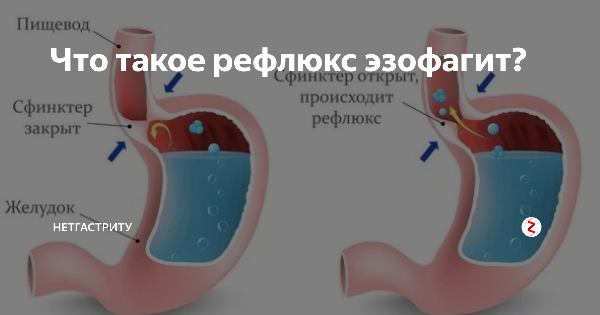 Как лечить заболевания органов пищеварения с помощью питания - Российская газета
