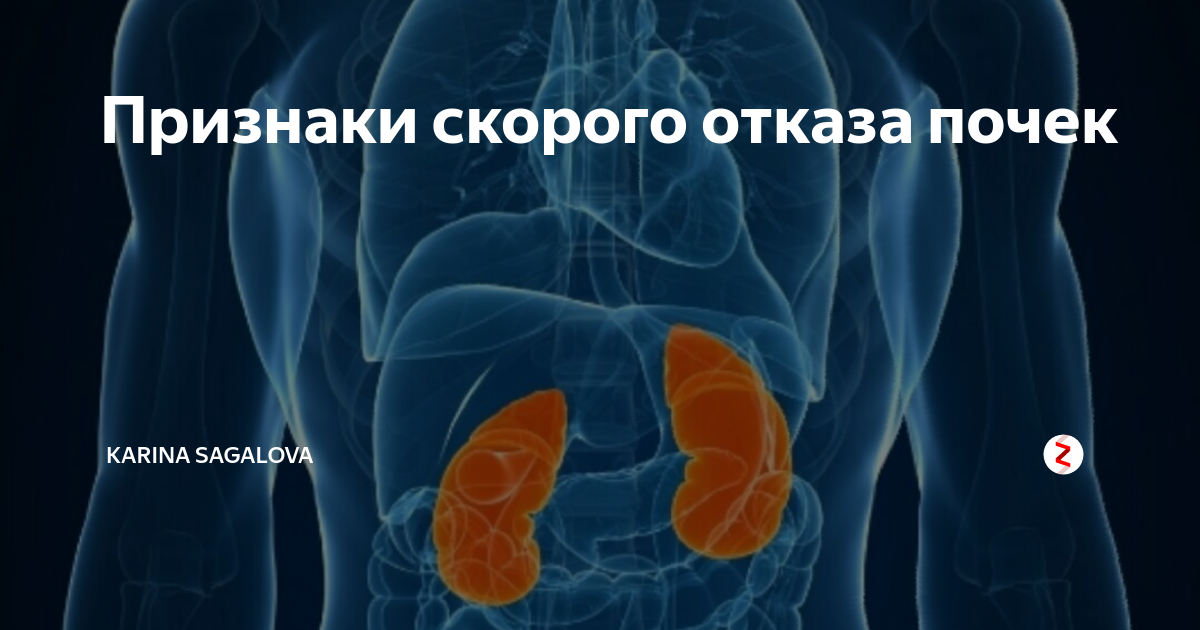 Если отказали почки сколько осталось жить человеку. Признаки что отказывают почки. Отказали почки симптомы. Отнимаются почки симптомы.