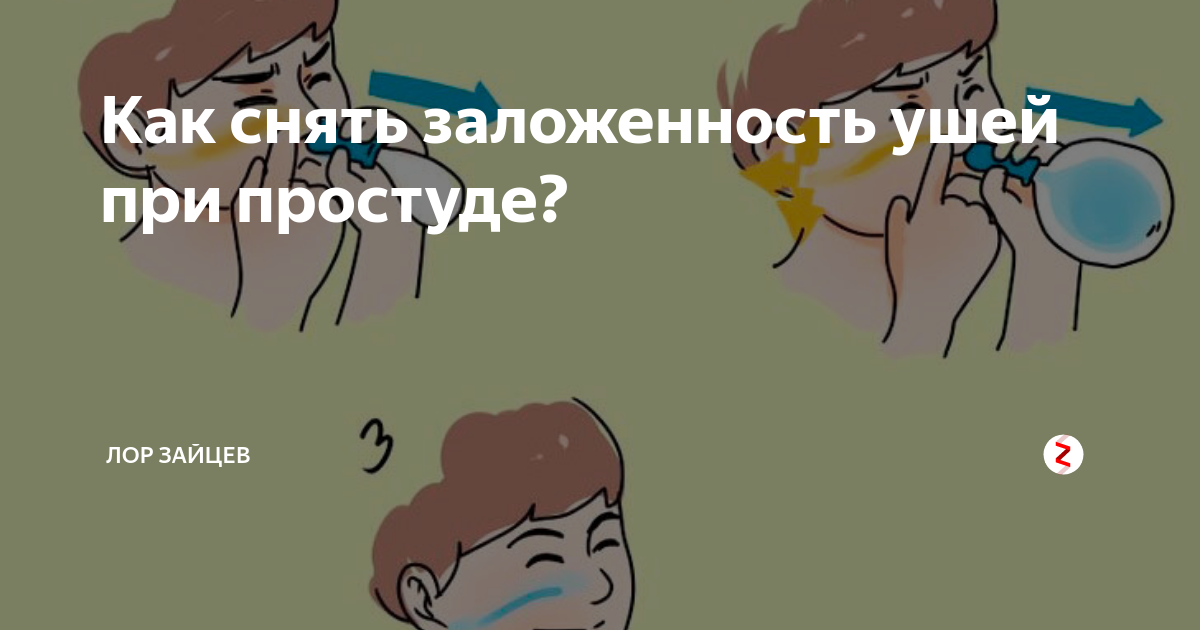 Как убрать заложенность. Заложило уши при простуде. Заложило ухо при насморке. Как избавиться от заложенности ушей. Как снять заложенность ушей при простуде.