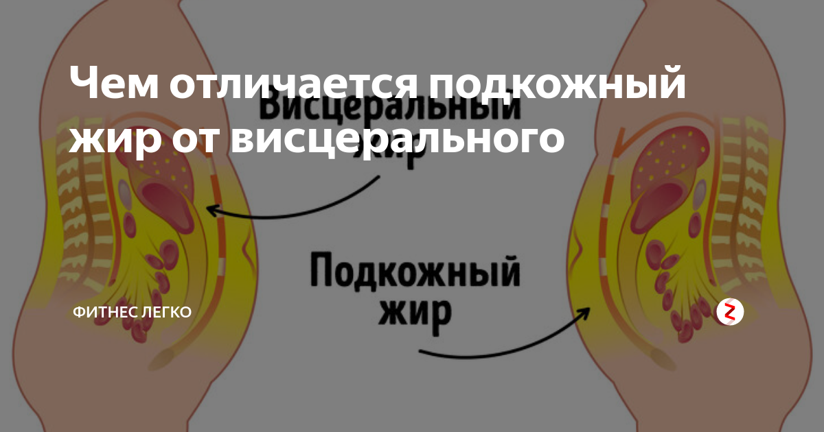 Как избавиться от висцерального жира у мужчин. Подкожный жир и висцеральный жир. Висцеральная жировая ткань.