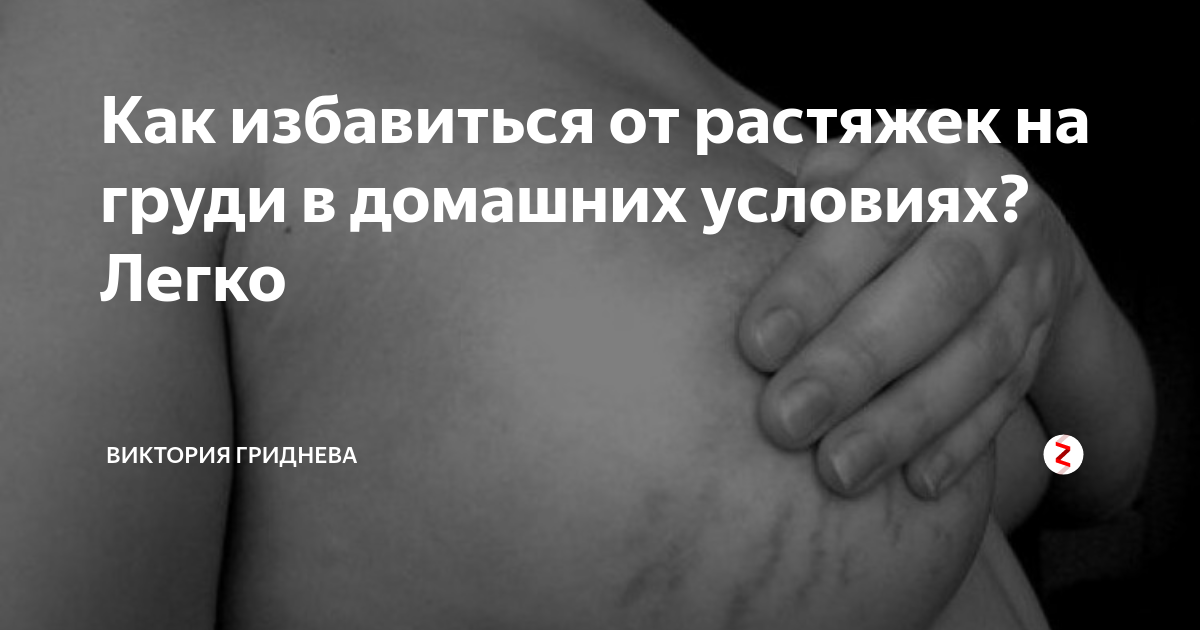 Как избавиться от растяжек?