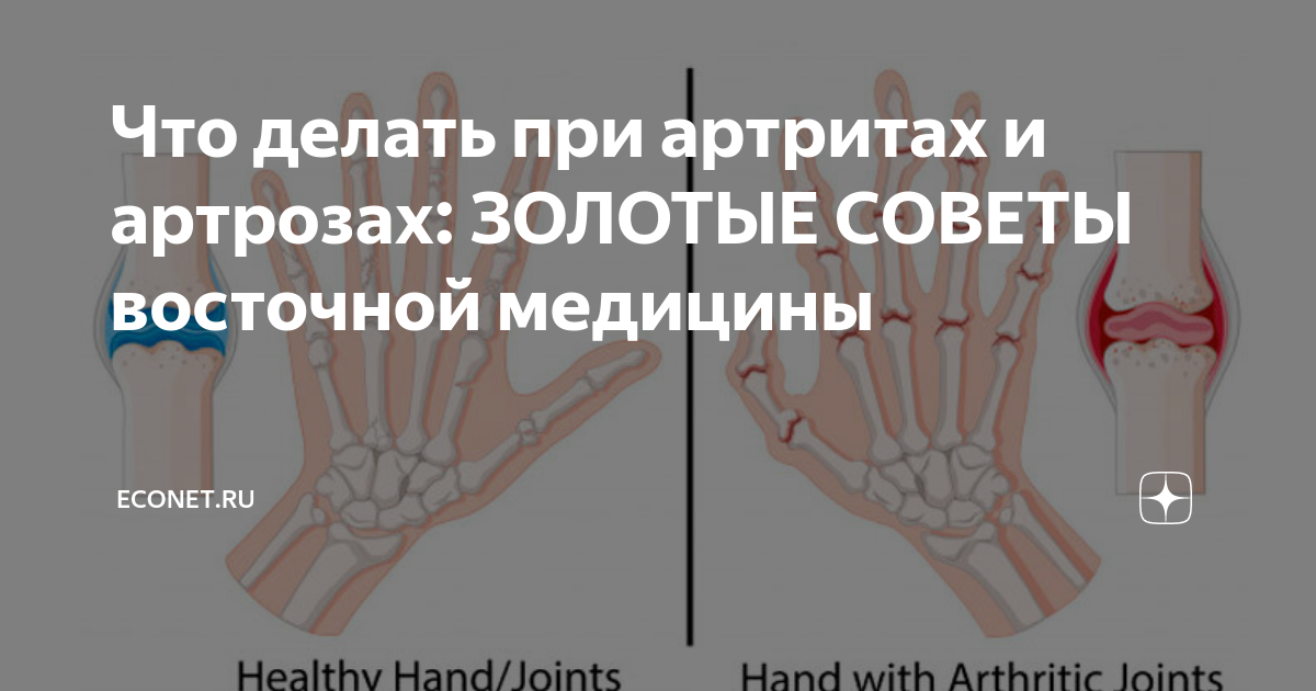 Лечение артрита пальцев народными средствами. Таблетки от артрита суставов рук и пальцев. Препараты от артрита пальцев рук суставов. Таблетки от артрита суставов рук. Таблетки при артрите пальцев рук.