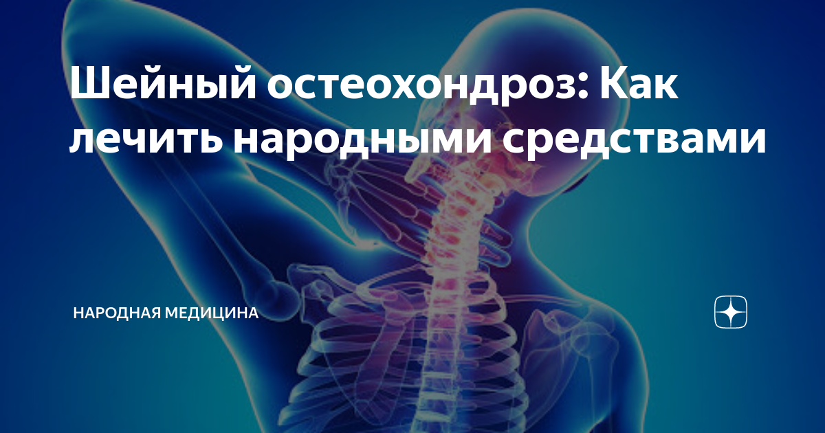 Лечим шейный остеохондроз народными средствами. Шейный хондроз. Симптомы шейного хондроза. Шейный остеохондроз излечим?. Шейный хондроз симптомы.