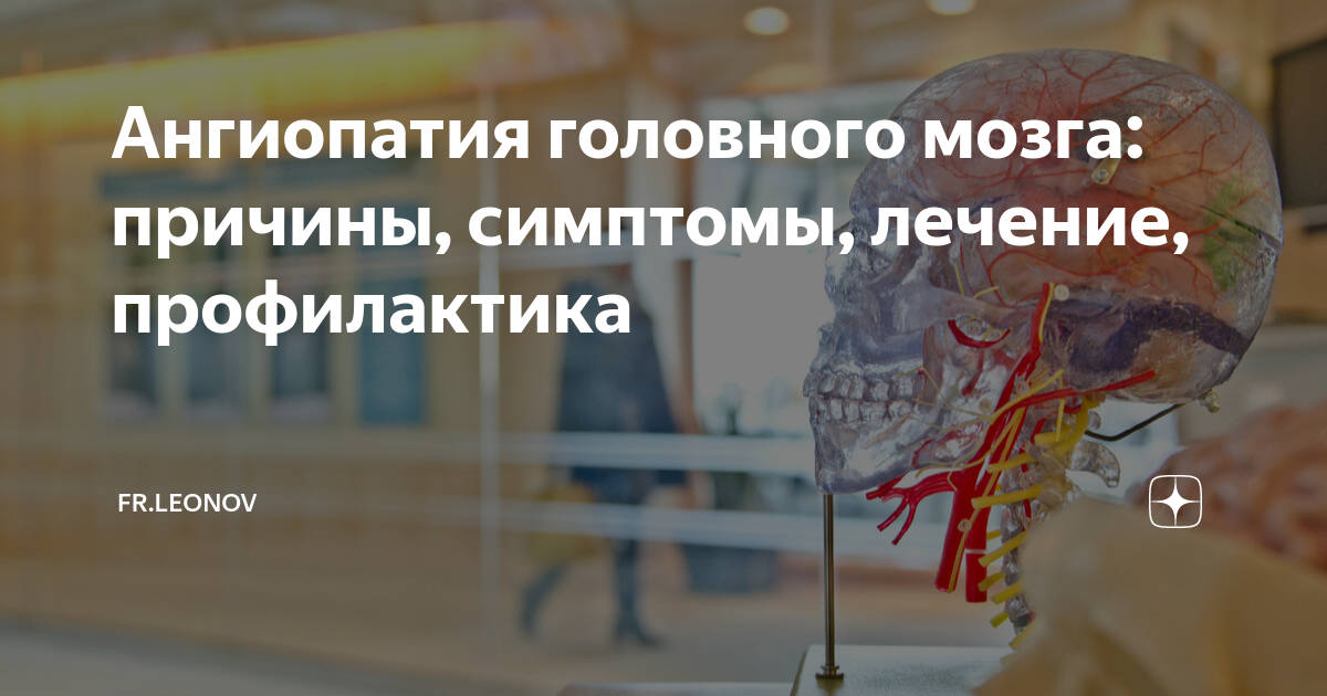 Ангиопатия головного мозга: причины, симптомы, лечение, профилактика ...