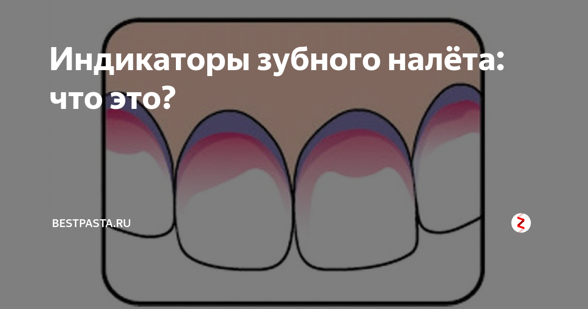 Индикация налета. Индикатор зубного налета. Индикатор зубного налета на зубах. Окрашивание зубного налета. Окрашивание зубов индикатором.