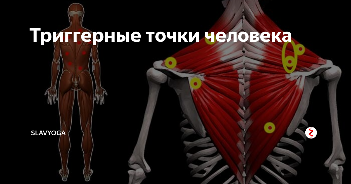 Триггерные точки на ногах схема
