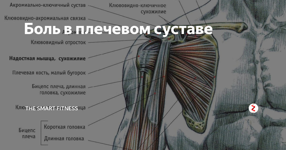 Боль в плечевом суставе при поднятии