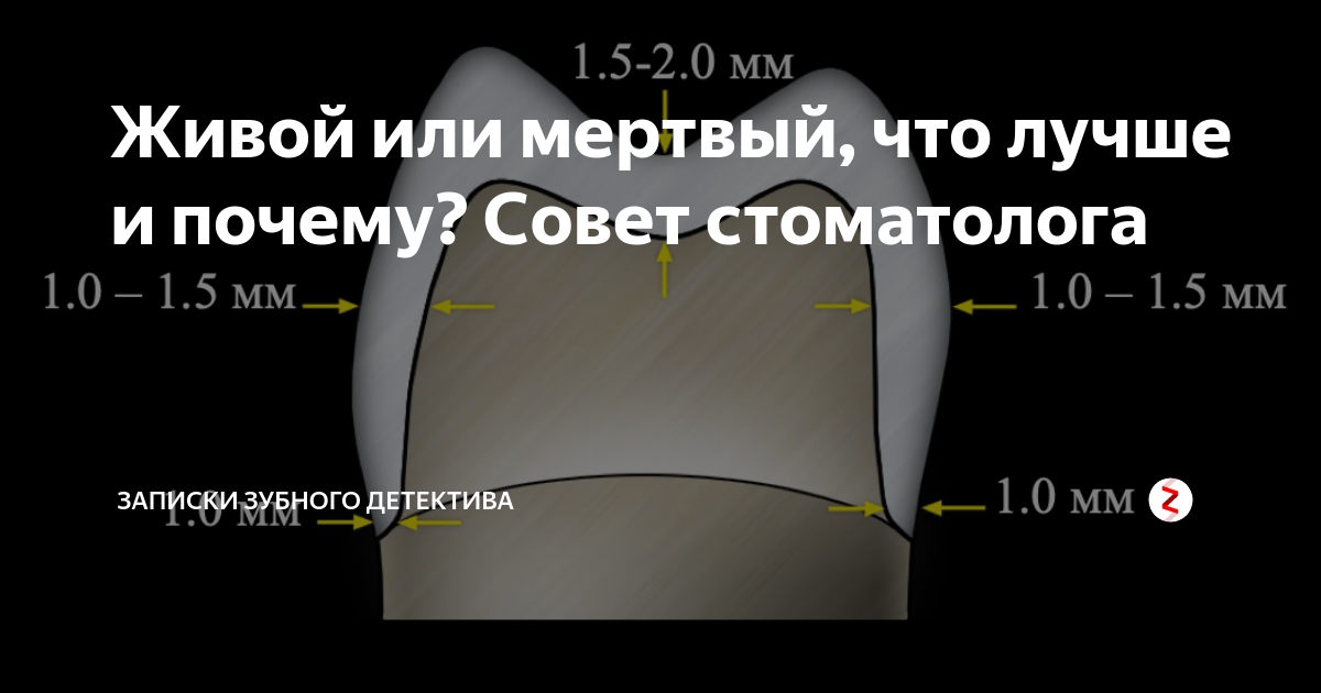 Дзен записки стоматолога. Зубной детектив дзен. Записки зубного детектива дзен импланты. Записки зубного детектива дзен. Записки зубного детектива читать.