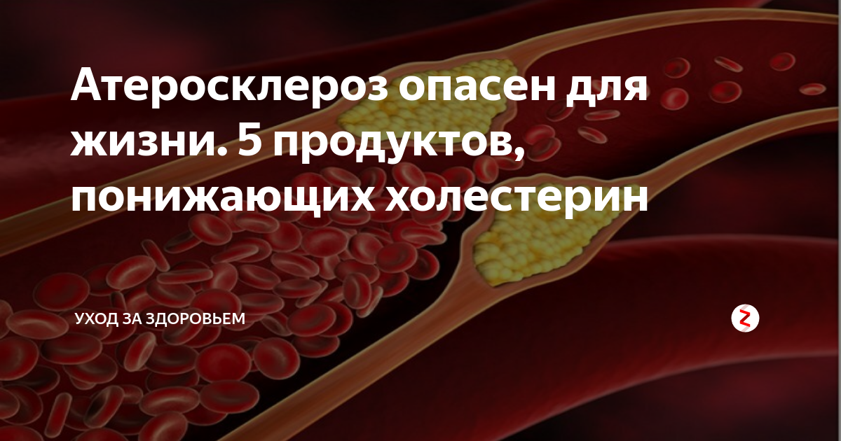 Холестерин после 50. Опасный холестерин. Холестерин для здоровья. Повышенный холестерин патологии. Наследственно повышенный холестерин крови.