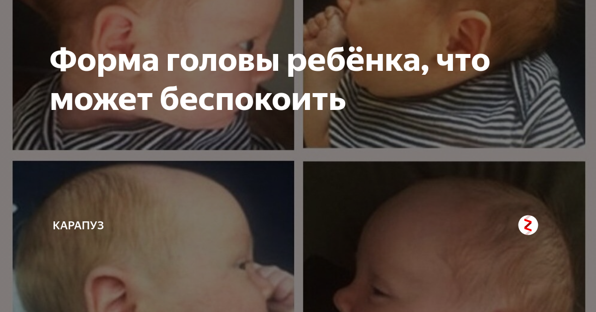 Скопление жидкости в голове