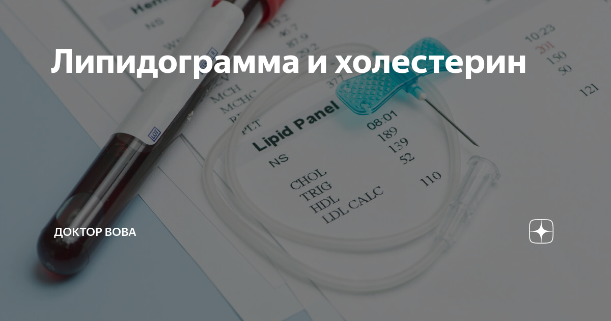 Липидограмма что это. Липидограмма крови цвет пробирки. Липидограмма акция. Акции на липидограмму. Липидограмма Йошкар-Ола.