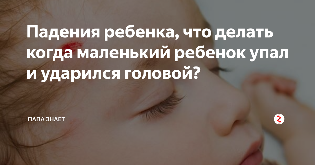 Ребенок упал и ударился головой: на что должны обратить внимание родители