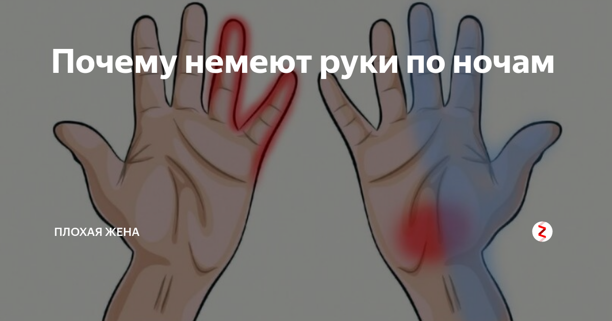 Почему немеет кисть во сне. Немеют руки причина. Левая рука отнимается и немеет. Лекарство от онемения пальцев рук. Немеют пальцы рук по ночам причины.