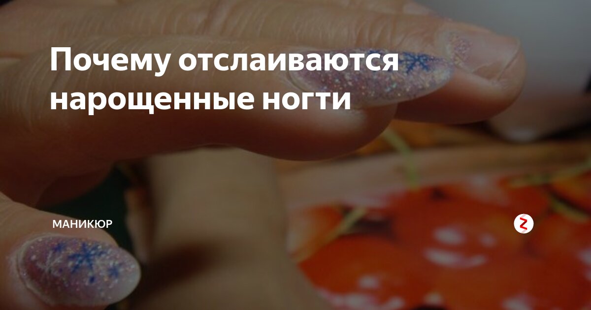 Нарощенный ноготь отошел вместе с моим(????) — 7 ответов | форум Babyblog