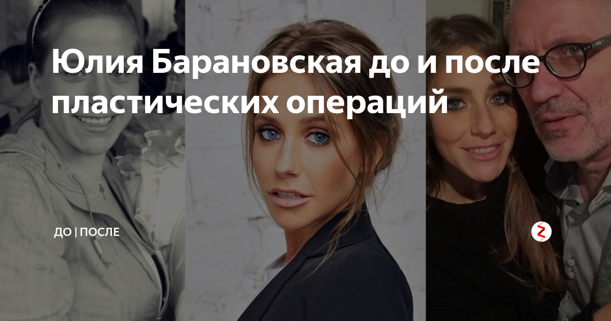 Барановская до и после пластики Хороший макияж и фотошоп творит чудеса