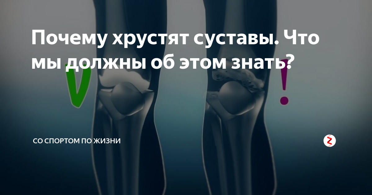 Хрустят суставы при вращении. Суставы хрустят причина. физиология хруста суставов.