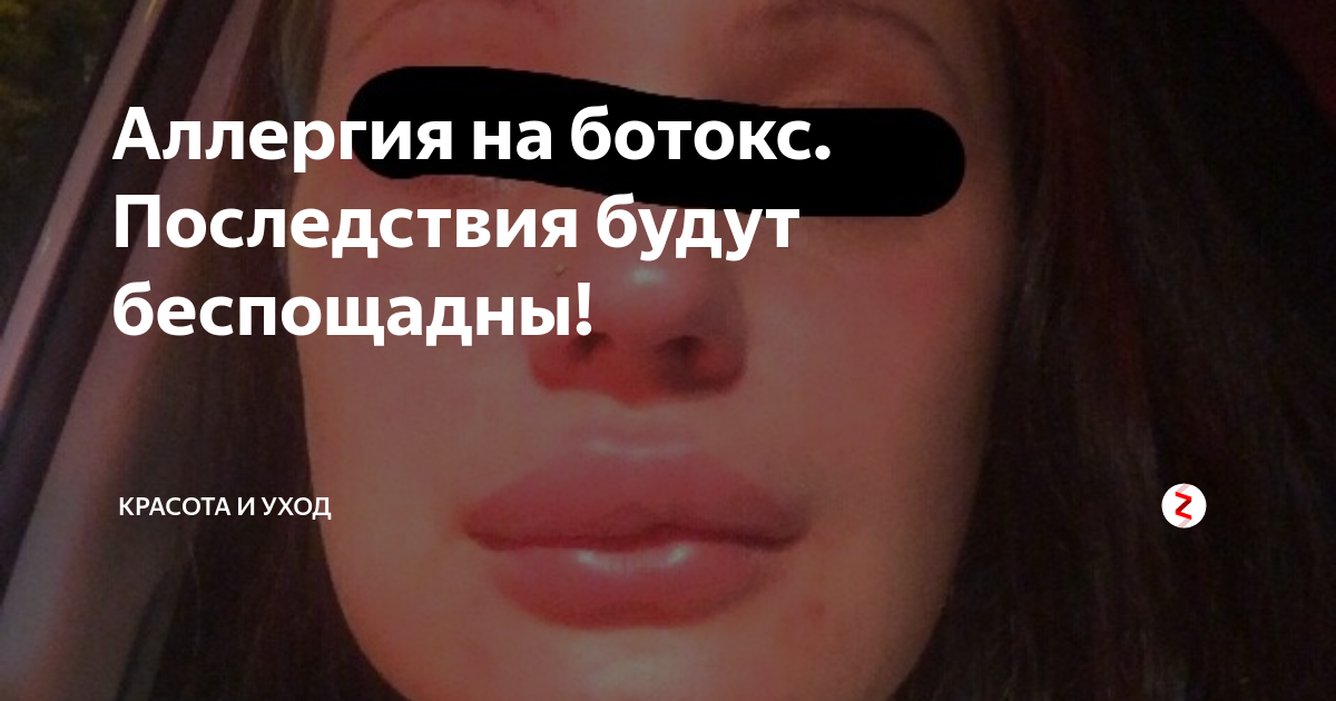 wrinkle-relaxer-botox-woman Juvly Aesthetics