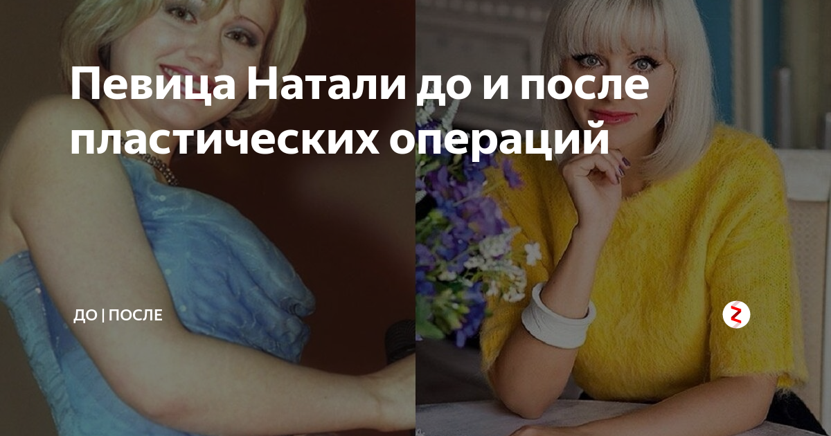 Натали после пластики. Натали певица до и после пластики. Натали певица до пластики. Натали певица после пластики. Натали до и после фото.