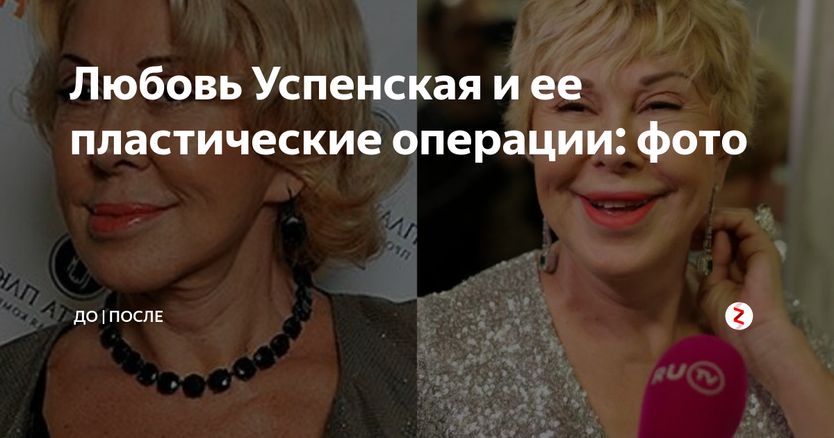 Бьюти-операции Любови Успенской 300 ЭКСПЕРТОВ Дзен