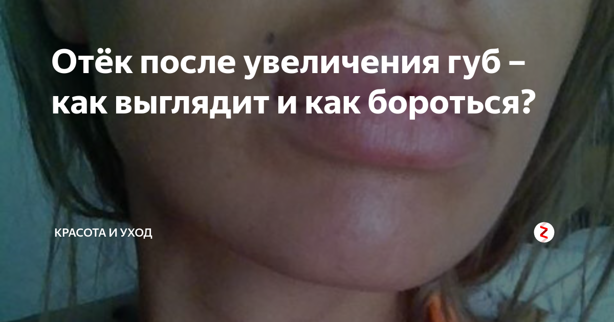 Ответы Mail.ru: ПРО уродство....см.вн.
