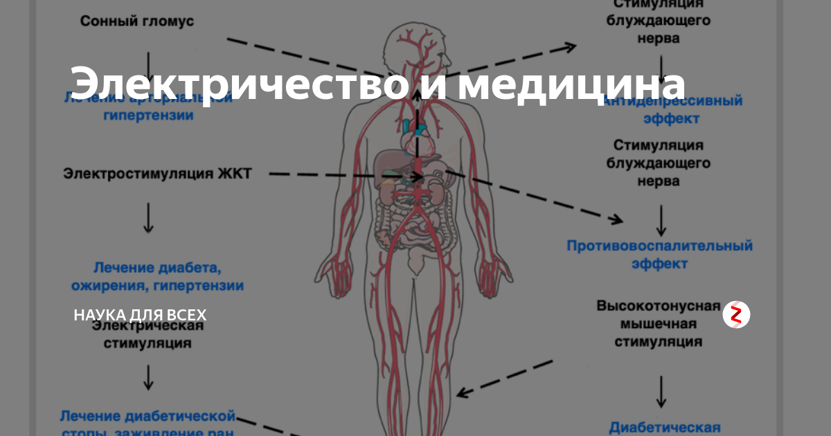 Применение целебного электричества в медицине проект по физике