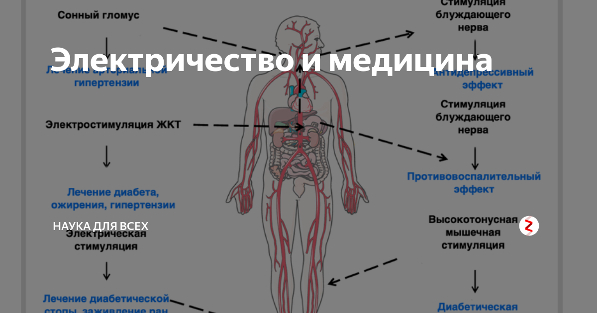 Применение целебного электричества в медицине проект