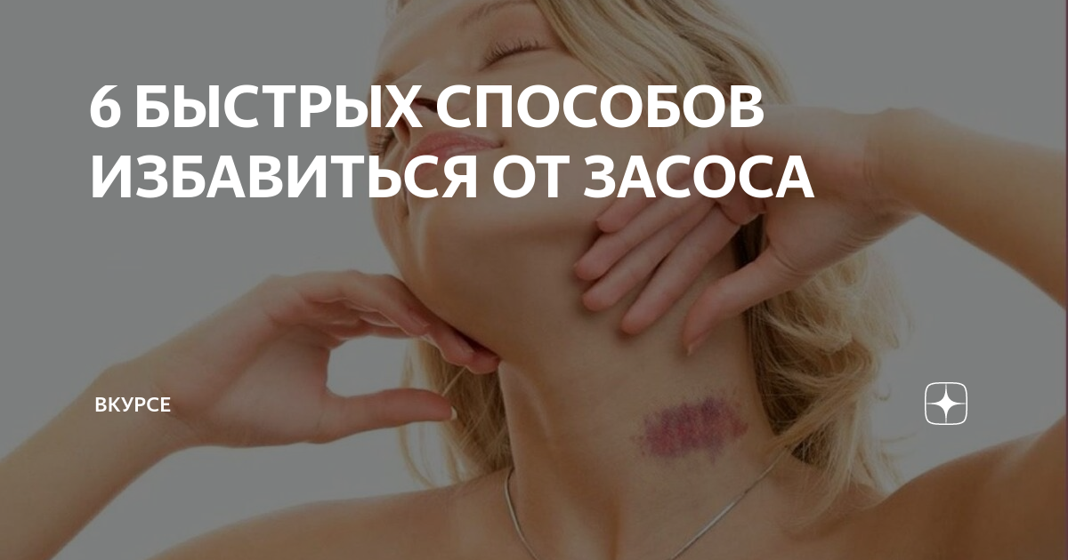 Как быстро убрать засос на шее. Как быстро убрать засос. Быстрое избавление от засоса. Как избавиться от засоса.