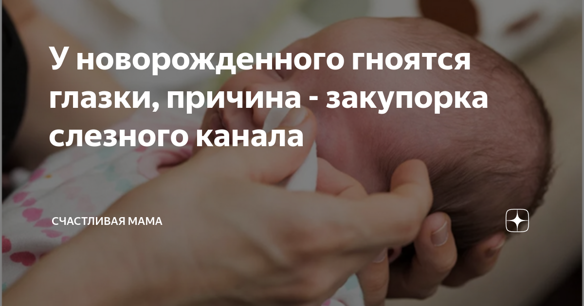 У новорожденного гноятся глазки, причина - закупорка слезного канала ...