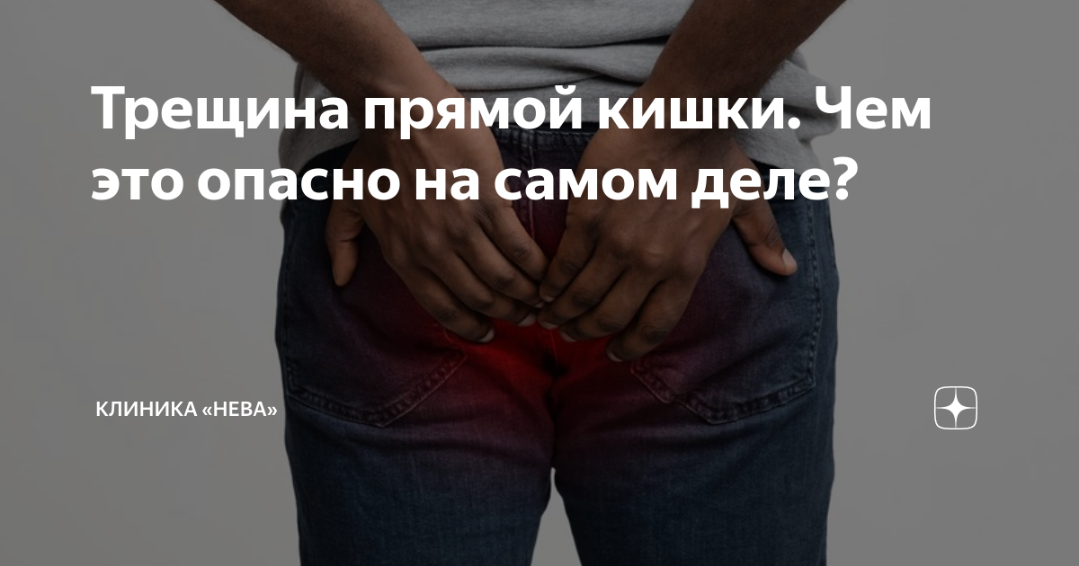 Трещина прямой кишки. Чем это опасно на самом деле? | Клиника «Нева» | Дзен