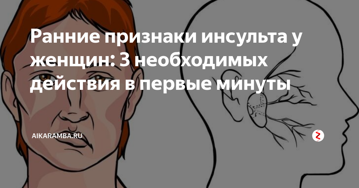 Признаки инсульта у женщины пожилого 70 лет. Предвестники инсульта у женщины симптомы. микроинсульт у женщин. первые признаки инсульта у женщин которые нельзя игнорировать. инсульт у детей симптомы.