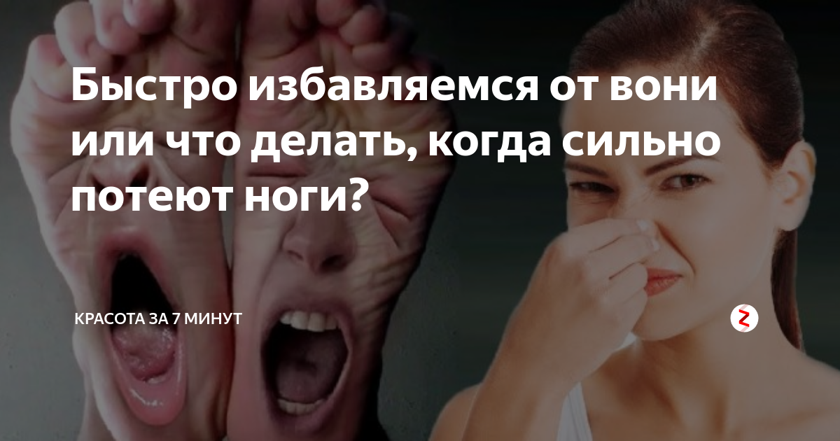 Почему потеют ноги и как с этим бороться?