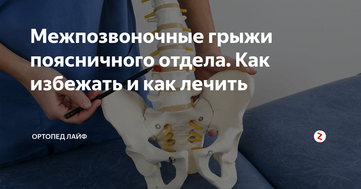 Грыжа как избежать. Пупочная грыжа дифференциальная диагностика. Грыжа поясничного отдела симптомы. Профилактика рецидивов грыж. Грыжа как избежать.