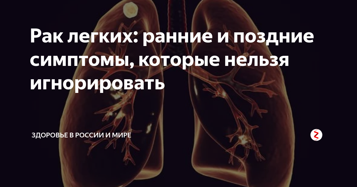 Что есть при раке легкого. Что есть при раке легкого