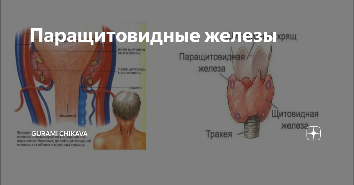 Паращитовидная железа удаление последствия. Аденома паращитовидной железы операция. Голотопия паращитовидной железы. Паращитовидная железа анатомия. Щитовидная железа и паращитовидная железа.