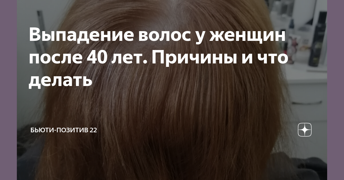 Причину выпадения волос после 40. Выпадение волос после 40 лет у женщин. Причины выпадения волос у женщин после 40. Почему выпадают волосы у женщин после 40. Поредели волосы на голове у женщины после 40 что делать.