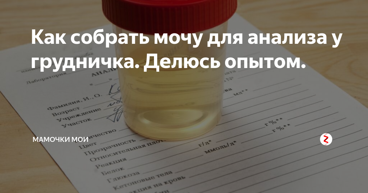 Как сдать мочу 1 год