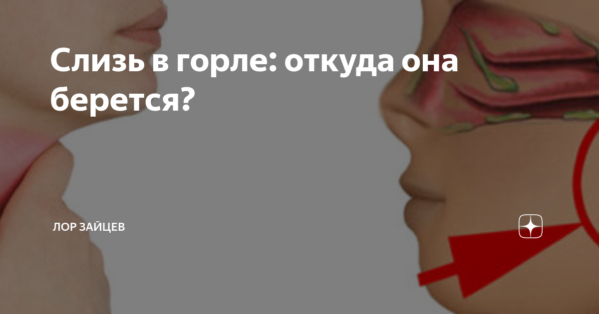 Сопли по задней стенке кашель. Слизь и мокрота в носоглотке. Застой слизи в носоглотке.