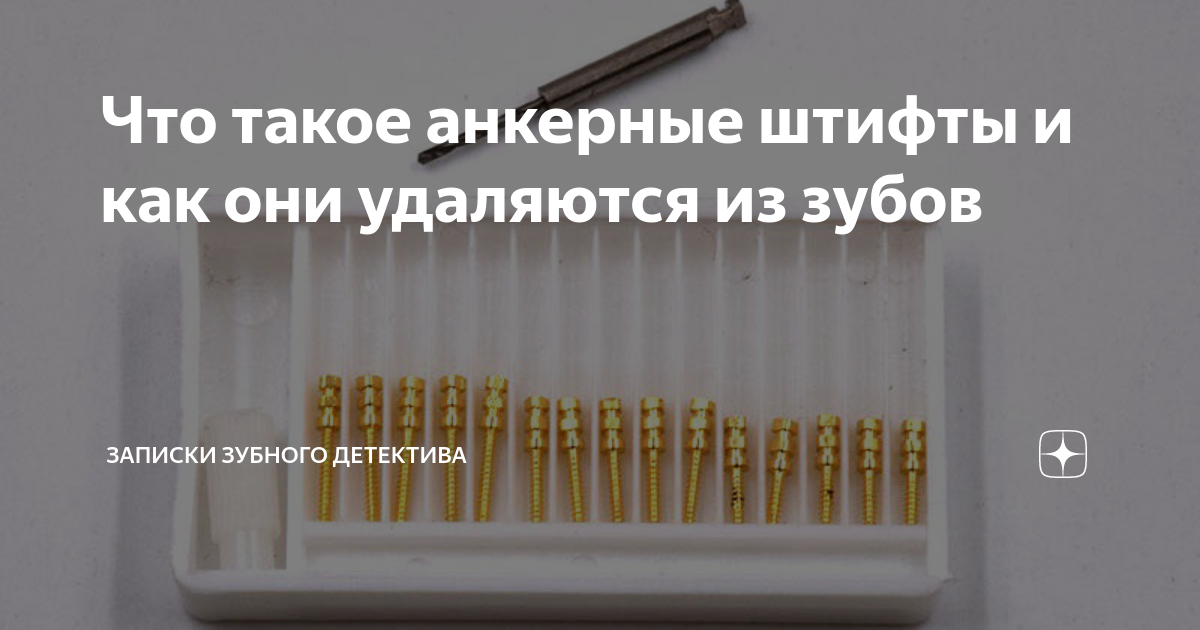 Что такое анкерные штифты и как они удаляются из зубов | записки ...