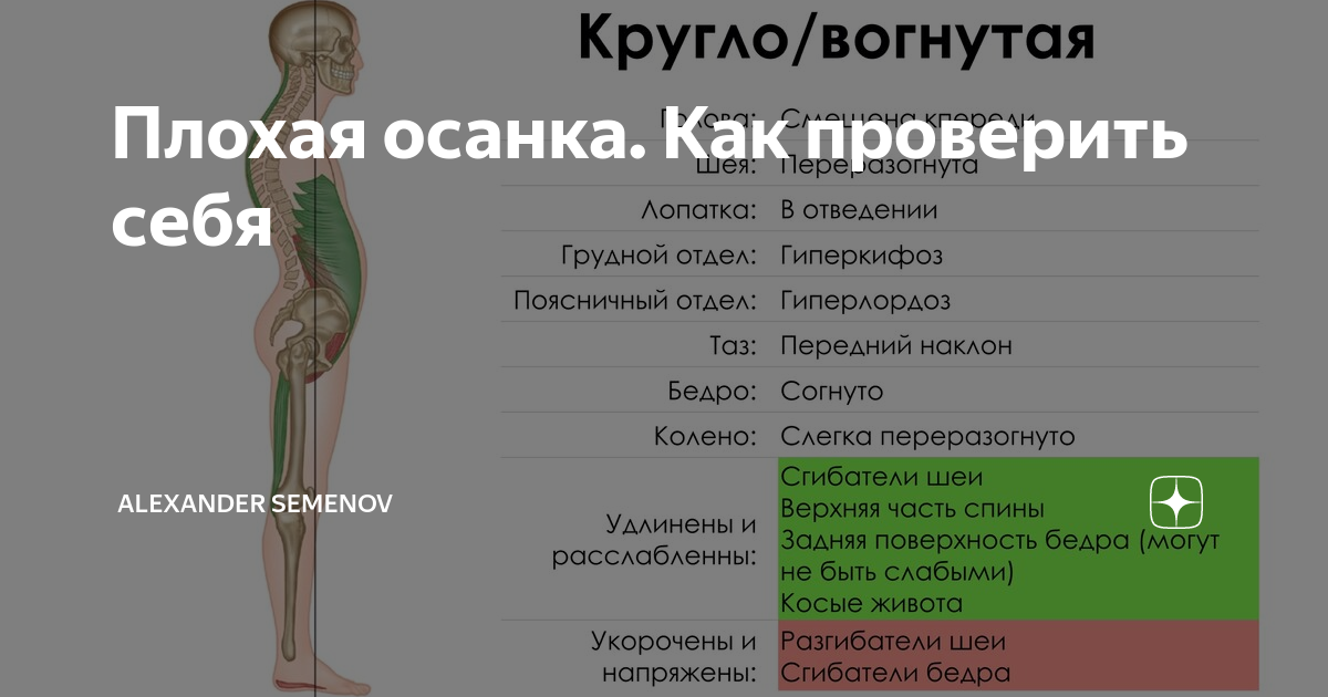 плохая осанка жениха 10 букв