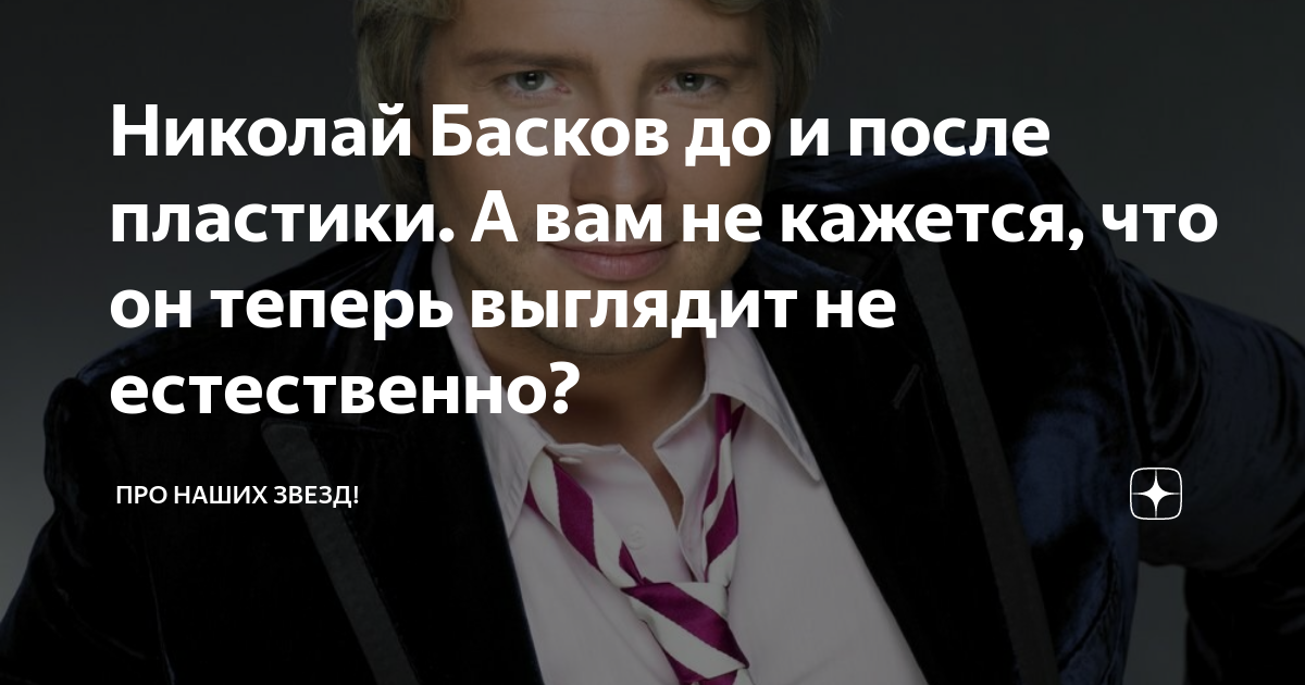 Николай Басков до и после пластики, фото, как выглядит сейчас 2023 (3 видео)