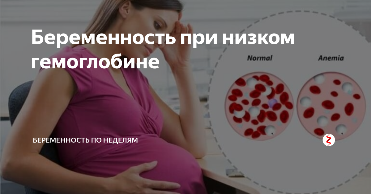 Анемия при беременности презентация