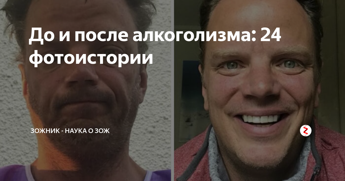 Алкоголизм до и после фото 25-year-old who drank every night turns life around and loses four stone in four