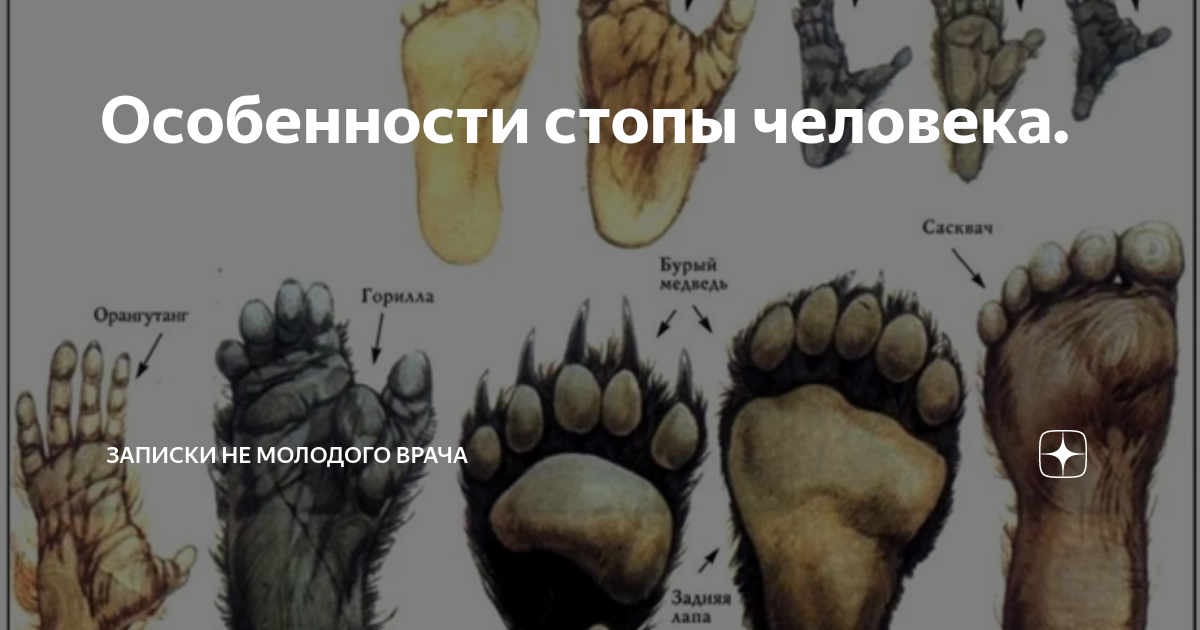 Виды стоп. Типы стоп. Типы стопы. Эволюция человеческой стопы. Особенности стопы