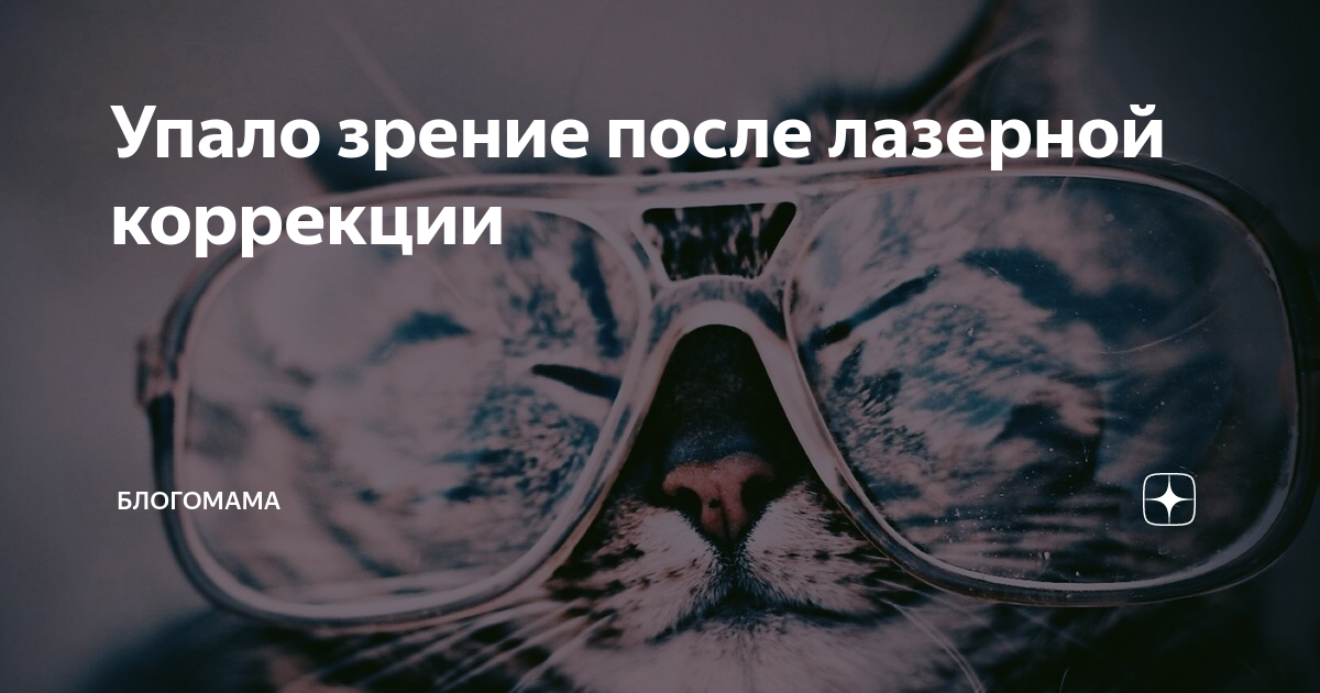 Эксимер-лазерная коррекция астигматизма. Лазерное излучение глаз. Lasik лазерный кератомилез. Фоторефракционная кератэктомия (коррекция зрения фрк). Коррекция зрения по технологии фрк (фоторефракционная кератэктомия).