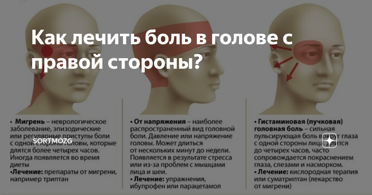 Головная боль в правой. Болит голова сзади правая сторона. Годоыа болит справой тороны. Болит голова в правой части головы. Болит гтлова СПРАВЛЙ стороны.