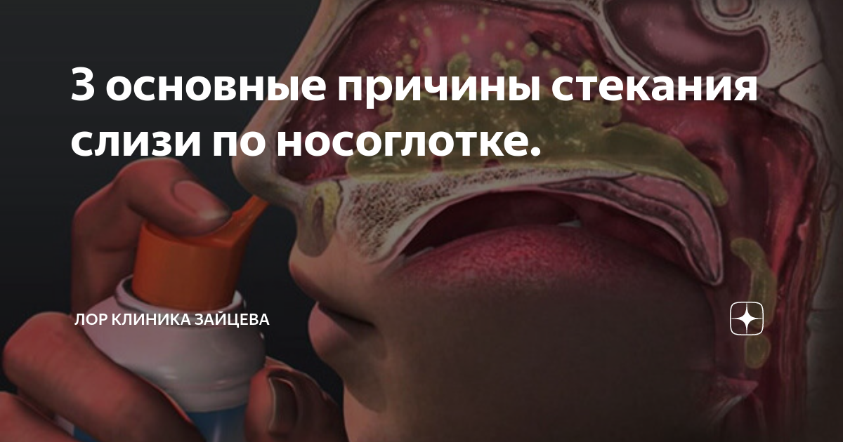 3 основные причины стекания слизи по носоглотке. | ЛОР КЛИНИКА ЗАЙЦЕВА ...